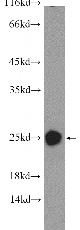 mouse brain tissue were subjected to SDS PAGE followed by western blot with Catalog No:109584(CRYBB2 Antibody) at dilution of 1:300
