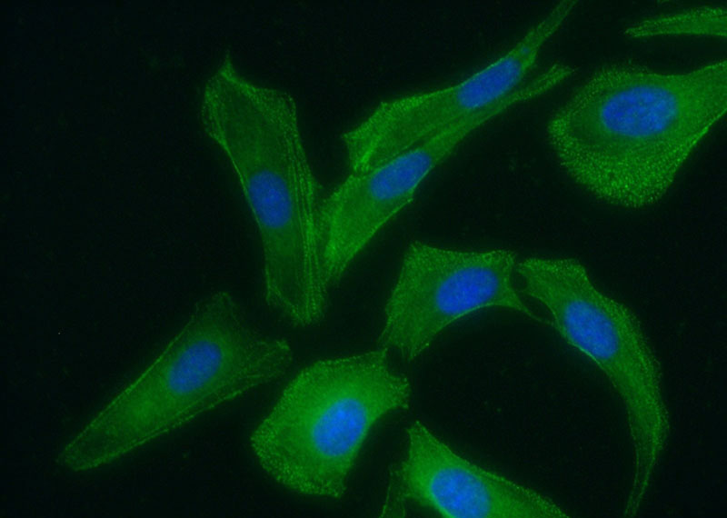 Immunofluorescent analysis of (-20oc Ethanol) fixed SKOV-3 cells using Catalog No:113633(PDLIM7,LMP1 Antibody) at dilution of 1:50 and Alexa Fluor 488-congugated AffiniPure Goat Anti-Rabbit IgG(H+L)