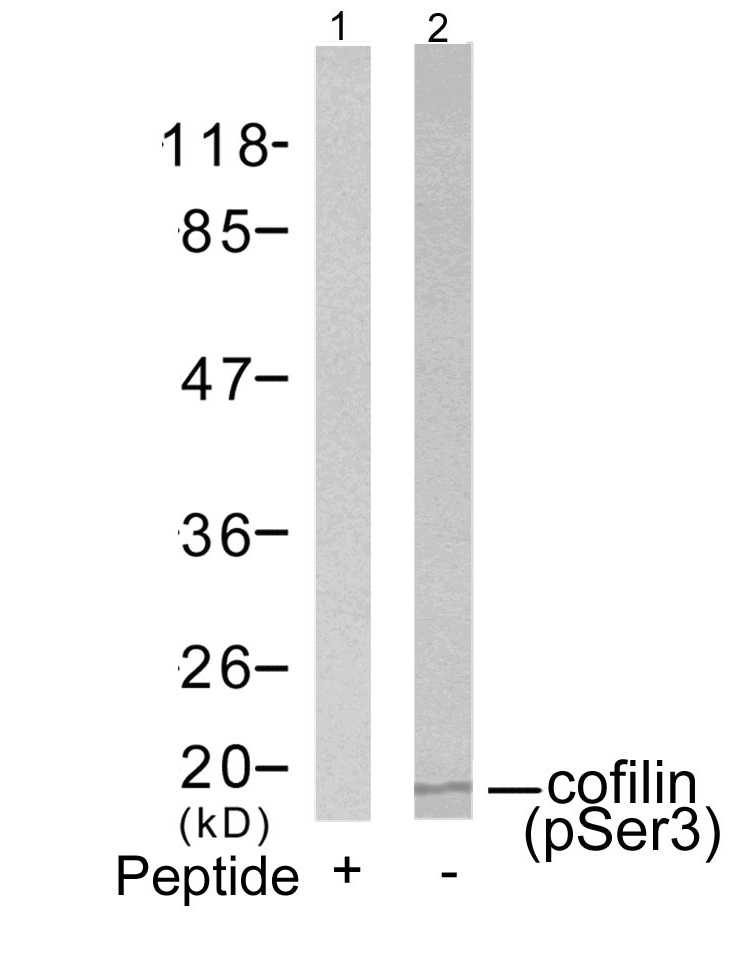 Western blot analysis of extracts from COLO205 cells using cofilin (Phospho-Ser3) Antibody  (Lane 2) and the same antibody preincubated with blocking peptide (Lane1).