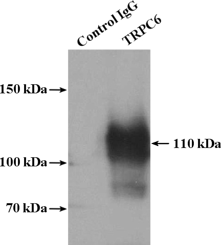 IP Result of anti-TRPC6 (IP:Catalog No:116409, 4ug; Detection:Catalog No:116409 1:300) with mouse lung tissue lysate 3600ug.