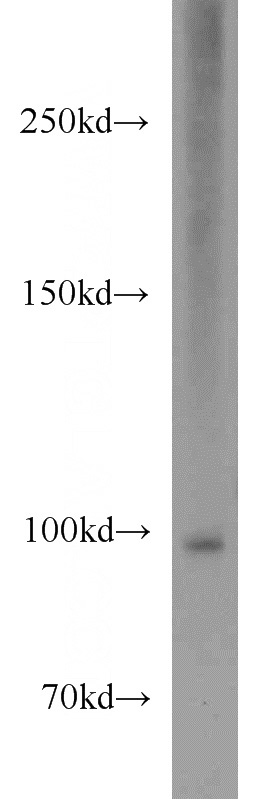 Jurkat cells were subjected to SDS PAGE followed by western blot with Catalog No:112954(NARG1L antibody) at dilution of 1:1000