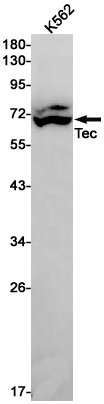 Western blot detection of Tec in K562 cell lysates using Tec Rabbit pAb(1:1000 diluted).Predicted band size:74kDa.Observed band size:58-75kDa.