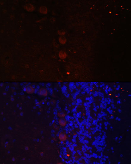 Immunofluorescence - NEFM Polyclonal Antibody 