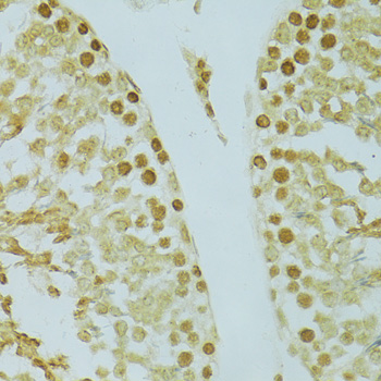 Immunohistochemistry - RCC1 Polyclonal Antibody 