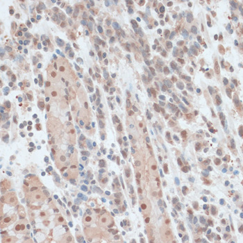 Immunohistochemistry - ZNF562 Polyclonal Antibody 