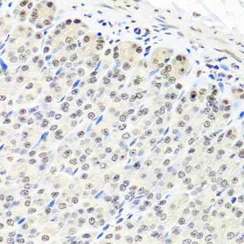 Immunohistochemistry - CNOT8 Polyclonal Antibody 