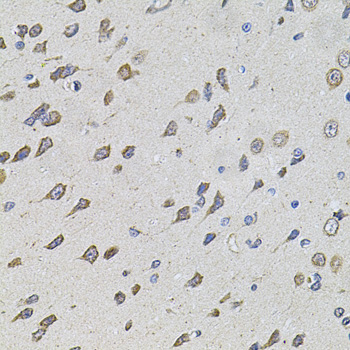 Immunohistochemistry - FoxO3a Polyclonal Antibody 