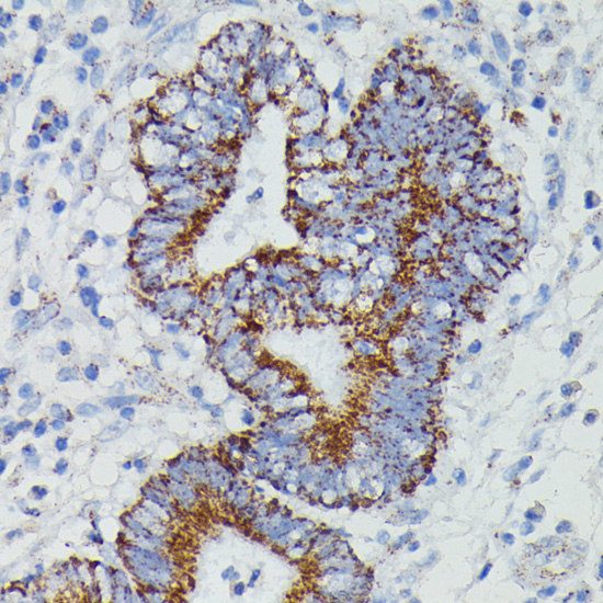Immunohistochemistry - NDUFAB1 Polyclonal Antibody 