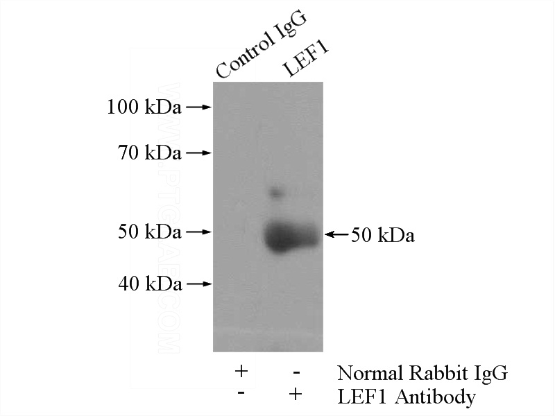 IP Result of anti-LEF1 (IP:Catalog No:112191, 4ug; Detection:Catalog No:112191 1:300) with SW 1990 cells lysate 2400ug.