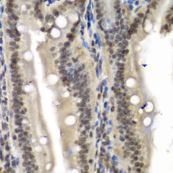 Immunohistochemistry - NELFE Polyclonal Antibody 