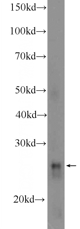 mouse kidney tissue were subjected to SDS PAGE followed by western blot with Catalog No:111148(GPX3 Antibody) at dilution of 1:600