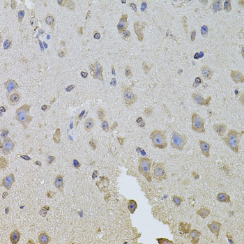 Immunohistochemistry - ITGB8 Polyclonal Antibody 