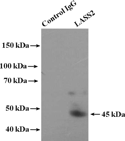 IP Result of anti-LASS2 (IP:Catalog No:112153, 4ug; Detection:Catalog No:112153 1:500) with HeLa cells lysate 3200ug.