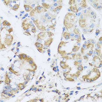 Immunohistochemistry - PRKAG1 Polyclonal Antibody 