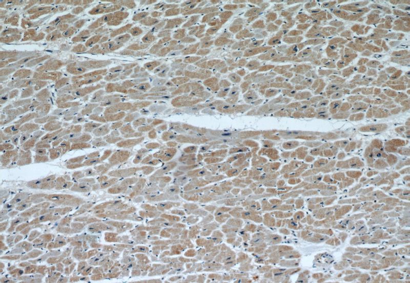 Immunohistochemical of paraffin-embedded human heart using Catalog No:111946(ITGB1BP1 antibody) at dilution of 1:50 (under 10x lens)