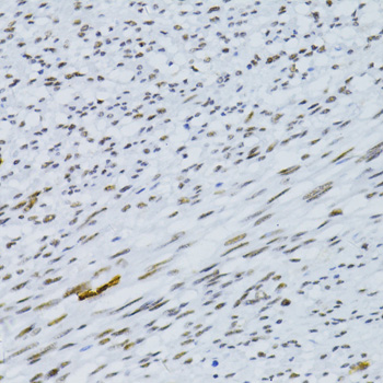 Immunohistochemistry - SNRNP70 Polyclonal Antibody 