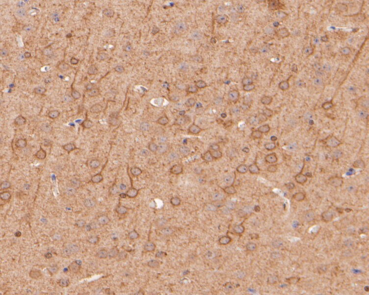 Fig4:; Immunohistochemical analysis of paraffin-embedded mouse brain tissue using anti-EPHA2 antibody. The section was pre-treated using heat mediated antigen retrieval with Tris-EDTA buffer (pH 8.0-8.4) for 20 minutes.The tissues were blocked in 5% BSA for 30 minutes at room temperature, washed with ddH; 2; O and PBS, and then probed with the primary antibody ( 1/50) for 30 minutes at room temperature. The detection was performed using an HRP conjugated compact polymer system. DAB was used as the chromogen. Tissues were counterstained with hematoxylin and mounted with DPX.