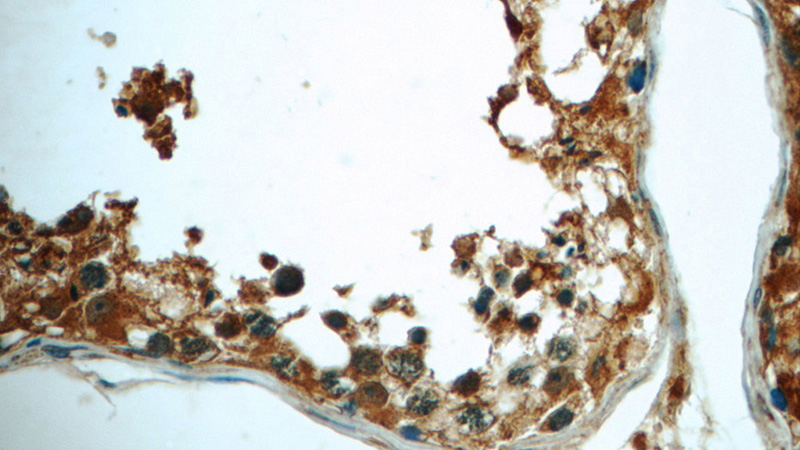 Immunohistochemistry of paraffin-embedded human testis tissue slide using Catalog No:108079(ANKRD53 Antibody) at dilution of 1:50 (under 40x lens)