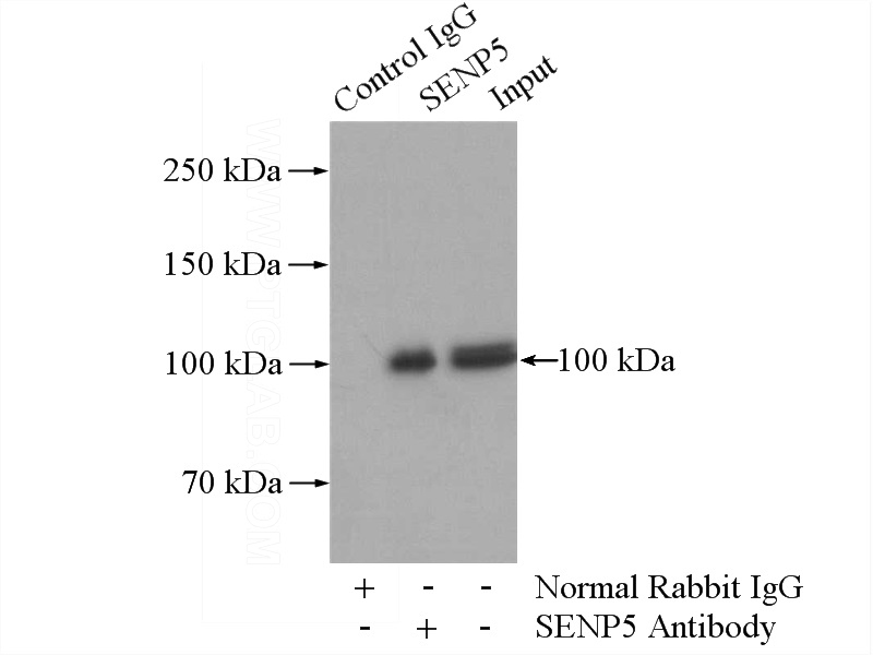 IP Result of anti-SENP5-Specific (IP:Catalog No:115110, 4ug; Detection:Catalog No:115110 1:300) with HeLa cells lysate 520ug.