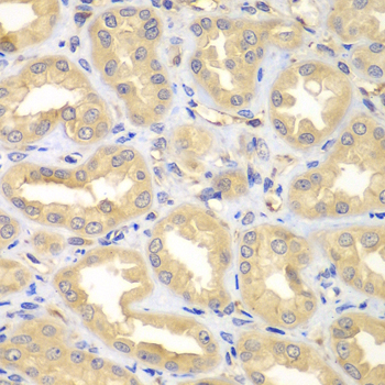 Immunohistochemistry - ELMO3 Polyclonal Antibody 