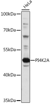 Western blot - PI4K2A Polyclonal Antibody 