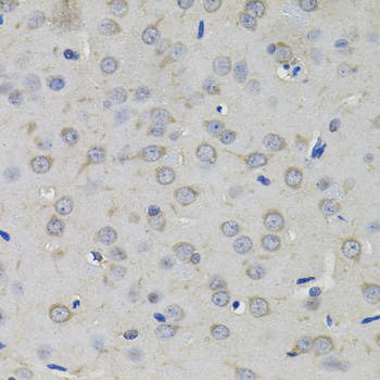 Immunohistochemistry - AMPD1 Polyclonal Antibody 
