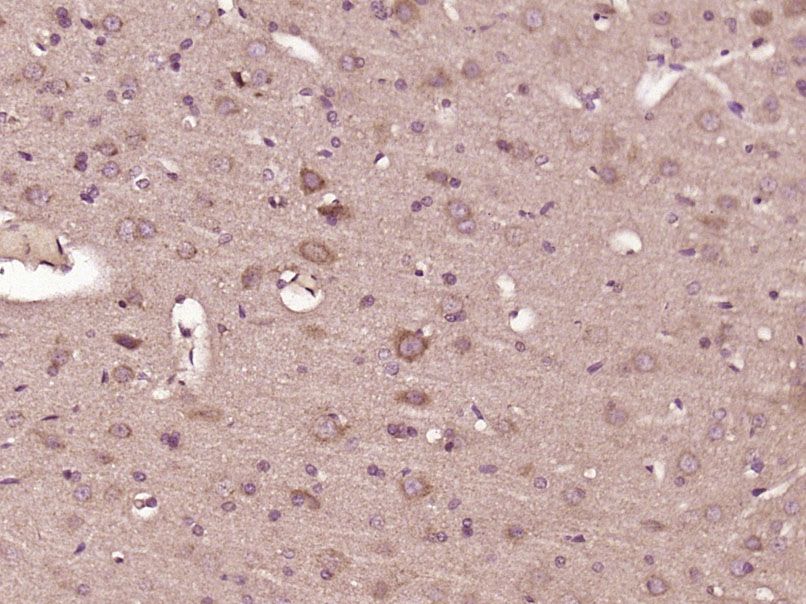 Fig2: Paraformaldehyde-fixed, paraffin embedded (Rat brain); Antigen retrieval by boiling in sodium citrate buffer (pH6.0) for 15min; Block endogenous peroxidase by 3% hydrogen peroxide for 20 minutes; Blocking buffer (normal goat serum) at 37℃ for 30min; Antibody incubation with (FSD1) Polyclonal Antibody, Unconjugated at 1:400 overnight at 4℃, followed by operating according to SP Kit(Rabbit) (sp-0023) instructionsand DAB staining.