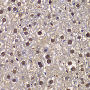 Immunohistochemistry - SMARCB1 Polyclonal Antibody 