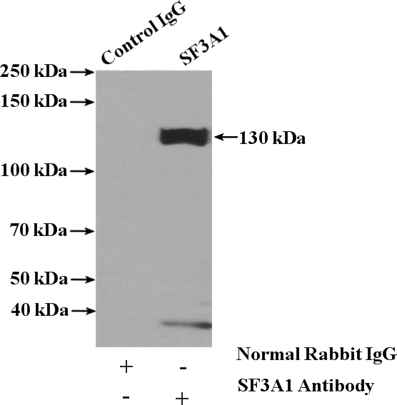 IP Result of anti-SF3A1 (IP:Catalog No:115133, 4ug; Detection:Catalog No:115133 1:500) with mouse brain tissue lysate 4000ug.