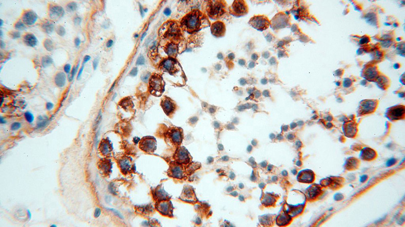 Immunohistochemical of paraffin-embedded human testis using Catalog No:110094(DNAJB3 antibody) at dilution of 1:100 (under 40x lens)