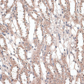 Immunohistochemistry - JMJD7 Polyclonal Antibody 