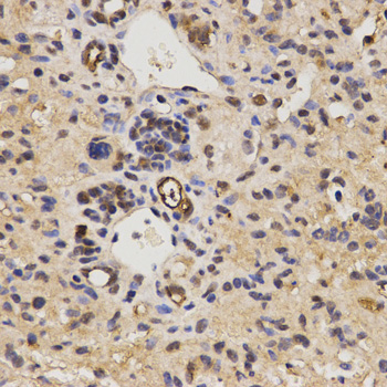 Immunohistochemistry - FAM160B2 Polyclonal Antibody 