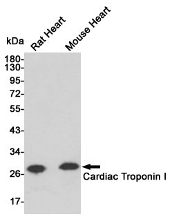 Western blot analysis of extracts from Rat and mouse heart tissue using Troponin I (168455,dilution 1:1000) Mouse mAb.Predicted band size:28kDa.Observed band size:28kDa.
