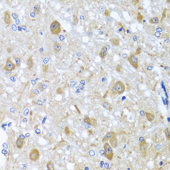 Immunohistochemistry - BNIP3L Polyclonal Antibody 