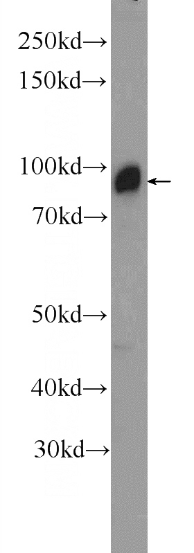 mouse brain tissue were subjected to SDS PAGE followed by western blot with Catalog No:114297(PSD95-Specific,DLG4 Antibody) at dilution of 1:300