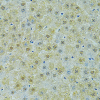 Immunohistochemistry - SOX14 Polyclonal Antibody 