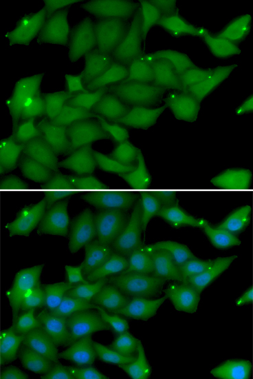 Immunofluorescence - RASGRF1 Polyclonal Antibody 