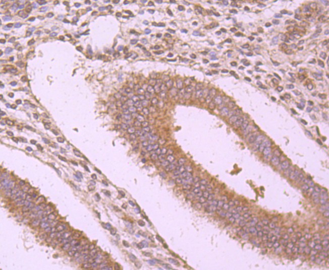 Fig6: Immunohistochemical analysis of paraffin-embedded human uterus tissue using anti-WSCD2 antibody. Counter stained with hematoxylin.