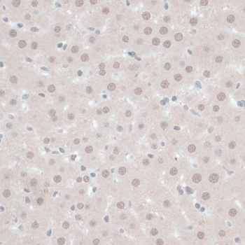 Immunohistochemistry - ZNF446 Polyclonal Antibody 