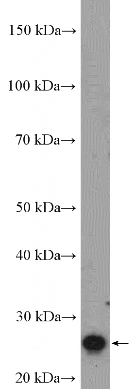 fetal human brain tissue were subjected to SDS PAGE followed by western blot with Catalog No:114645(RGS2 Antibody) at dilution of 1:600
