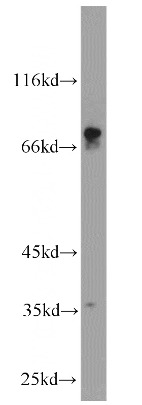 mouse brain tissue were subjected to SDS PAGE followed by western blot with Catalog No:108762(CACNB1 antibody) at dilution of 1:500