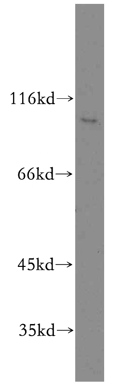 HepG2 cells were subjected to SDS PAGE followed by western blot with Catalog No:114709(RIN3 antibody) at dilution of 1:300
