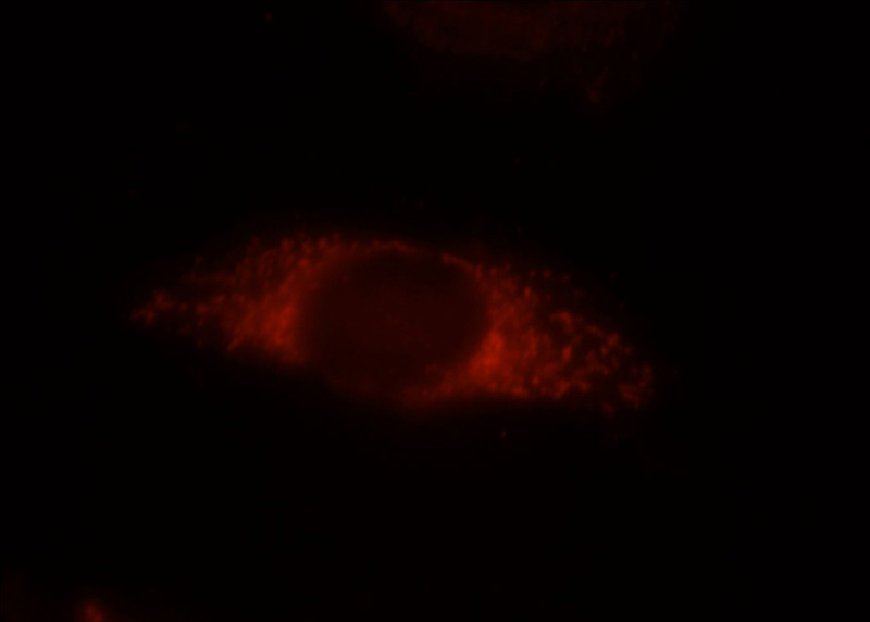 Immunofluorescent analysis of HepG2 cells, using VHL antibody Catalog No:116748 at 1:25 dilution and Rhodamine-labeled goat anti-rabbit IgG (red).