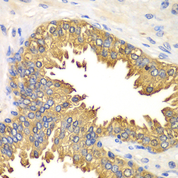 Immunohistochemistry - RIG-I / DDX58 Polyclonal Antibody 