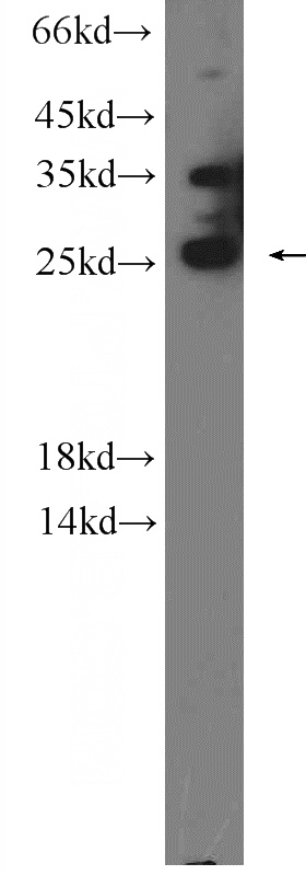mouse brain tissue were subjected to SDS PAGE followed by western blot with Catalog No:114279(PRRX2 Antibody) at dilution of 1:600