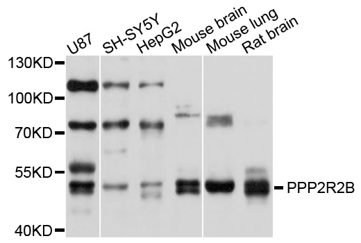 Western blot - PPP2R2B Polyclonal Antibody 
