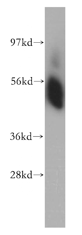 human kidney tissue were subjected to SDS PAGE followed by western blot with Catalog No:115276(SHMT1 antibody) at dilution of 1:500