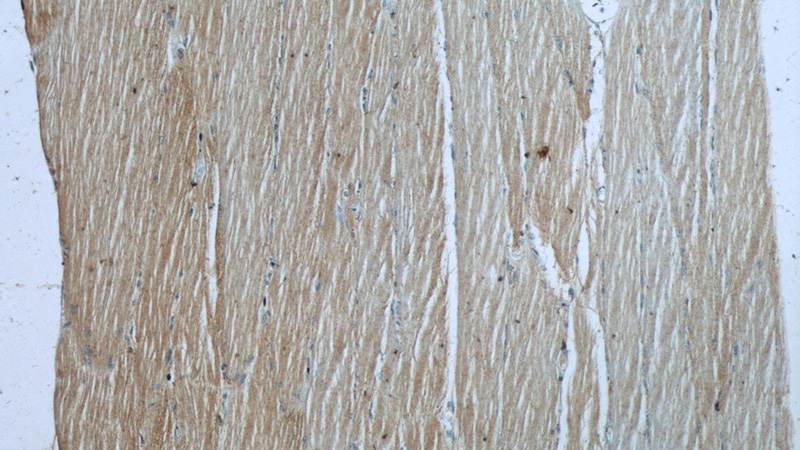 Immunohistochemistry of paraffin-embedded human skeletal muscle slide using Catalog No:112341(LRSAM1 Antibody) at dilution of 1:50