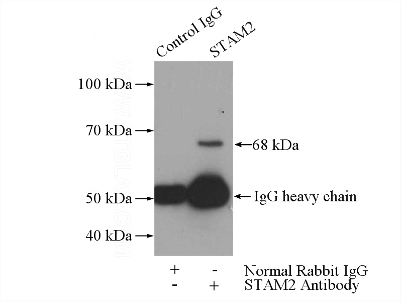 IP Result of anti-STAM2 (IP:Catalog No:115673, 4ug; Detection:Catalog No:115673 1:1000) with mouse brain tissue lysate 3440ug.