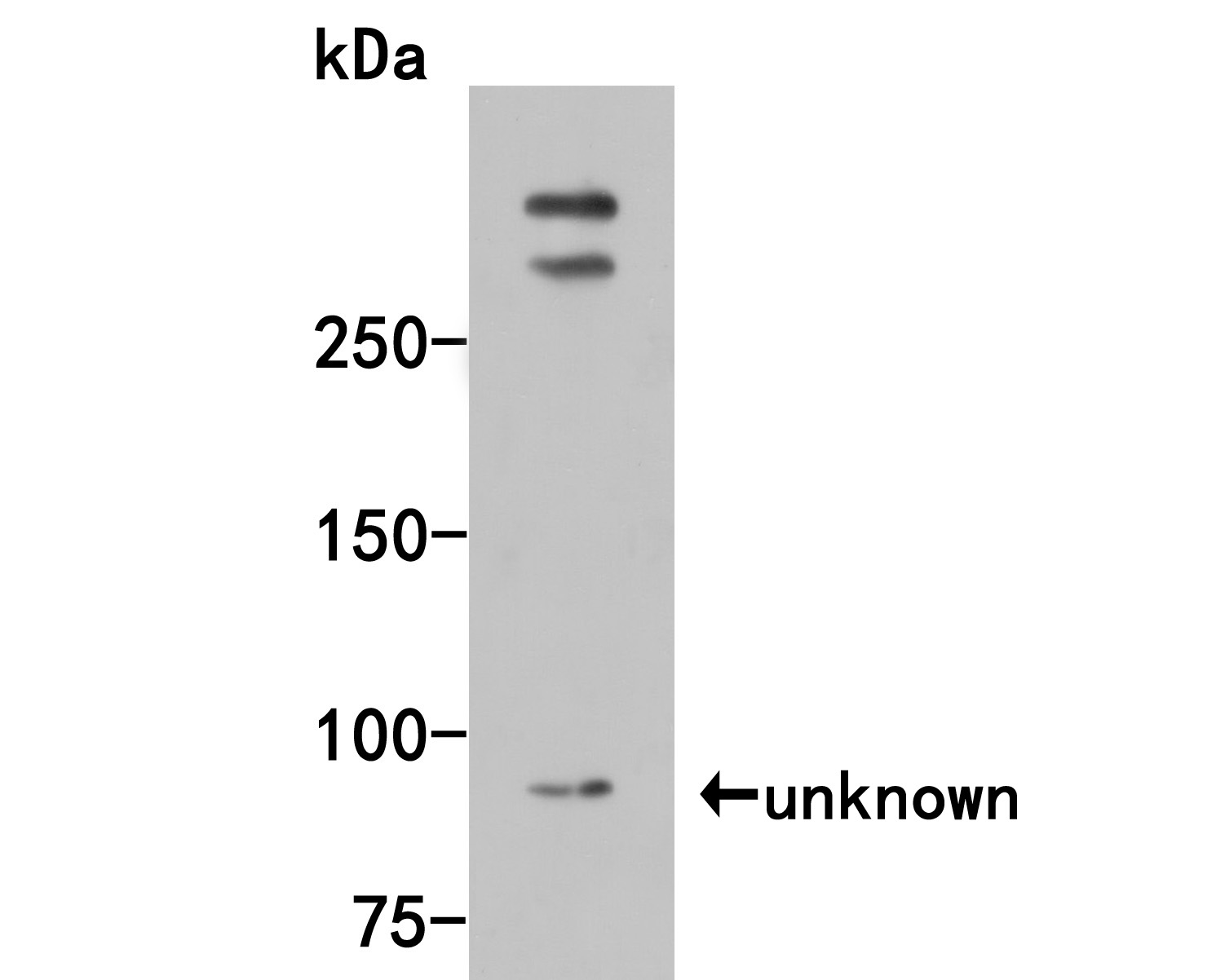 Fig1:; Western blot analysis of Smg1 on Hela cell lysates. Proteins were transferred to a PVDF membrane and blocked with 5% BSA in PBS for 1 hour at room temperature. The primary antibody ( 1/500) was used in 5% BSA at room temperature for 2 hours. Goat Anti-Rabbit IgG - HRP Secondary Antibody (HA1001) at 1:5,000 dilution was used for 1 hour at room temperature.